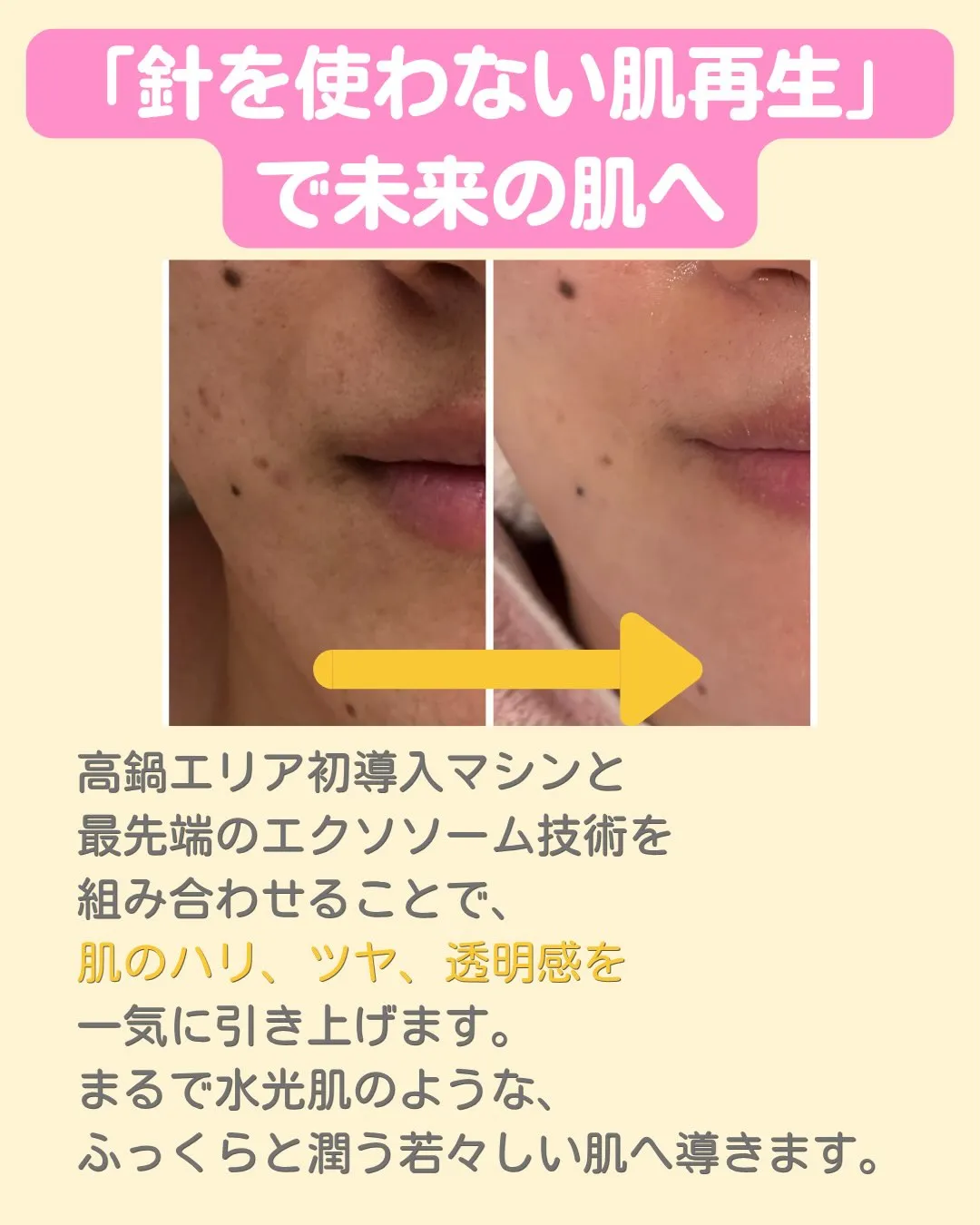 宮崎県児湯郡高鍋の肌再生サロン、Fikaの竹原です😊